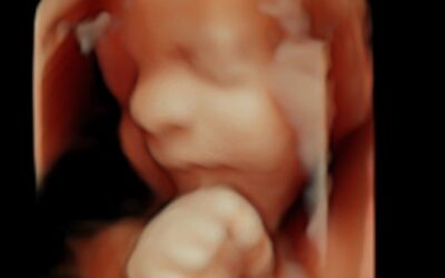 Private Pregnancy Scans to Determine the Gestational Age of a Baby